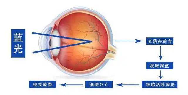 如何选购对眼睛伤害小的电视