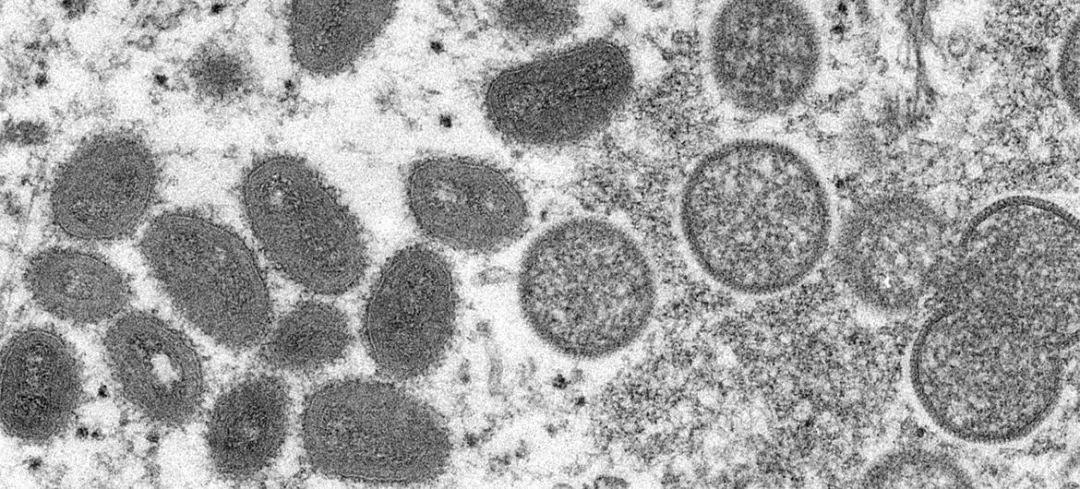 美国最新疫情，探究、关注与理解